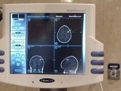 Neuronavegación optimiza la resección de tumores y la colocación de implantes