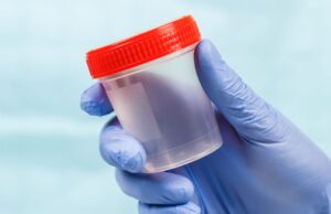 Cerca de mil personas se someten al cribado renal del proyecto Radar en Extremadura